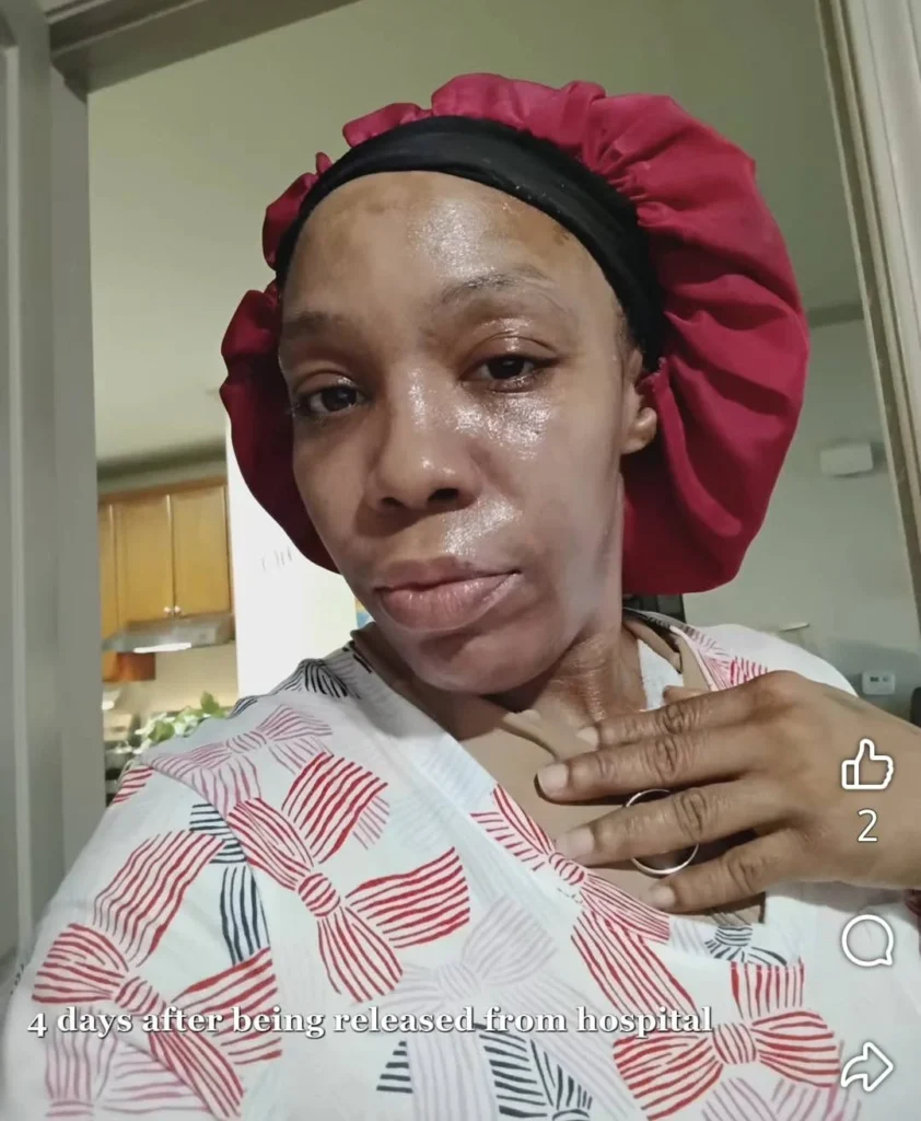 Joven quemada con parches aplicados